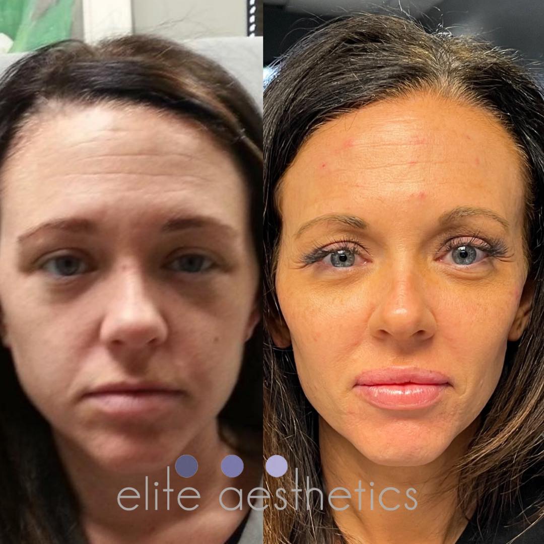 What should I look for in a quality med spa?